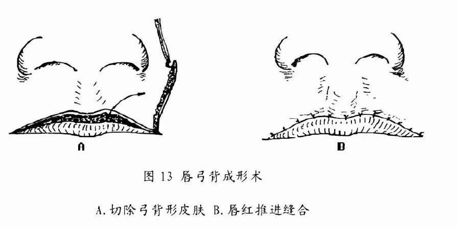 三、申請條件與流程：如何獲得免費修復機會
