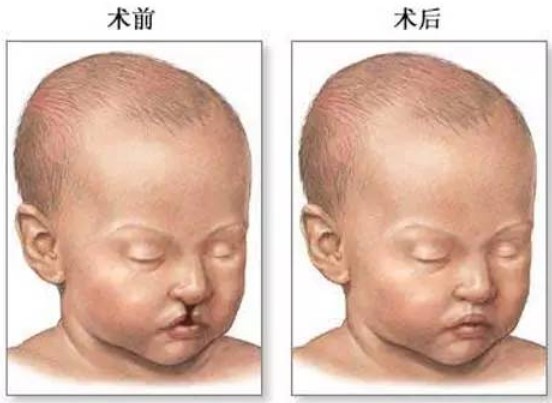 四、手術療效與變好：術后護理指南www.sorencai.cn