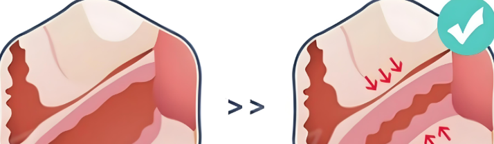 周宇醫(yī)生私密緊縮術(shù)怎么樣？