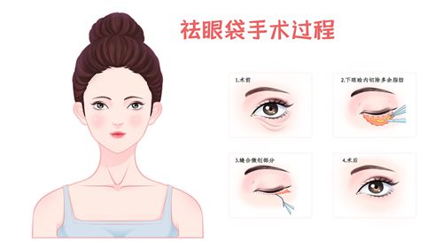 成都做眼袋效果好的醫(yī)院