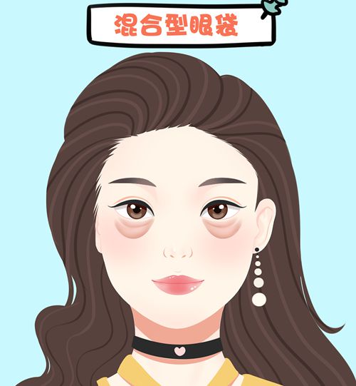 廣州華美醫(yī)院提眉手術(shù)多少錢？2500-5500元覆蓋不同方案超清晰