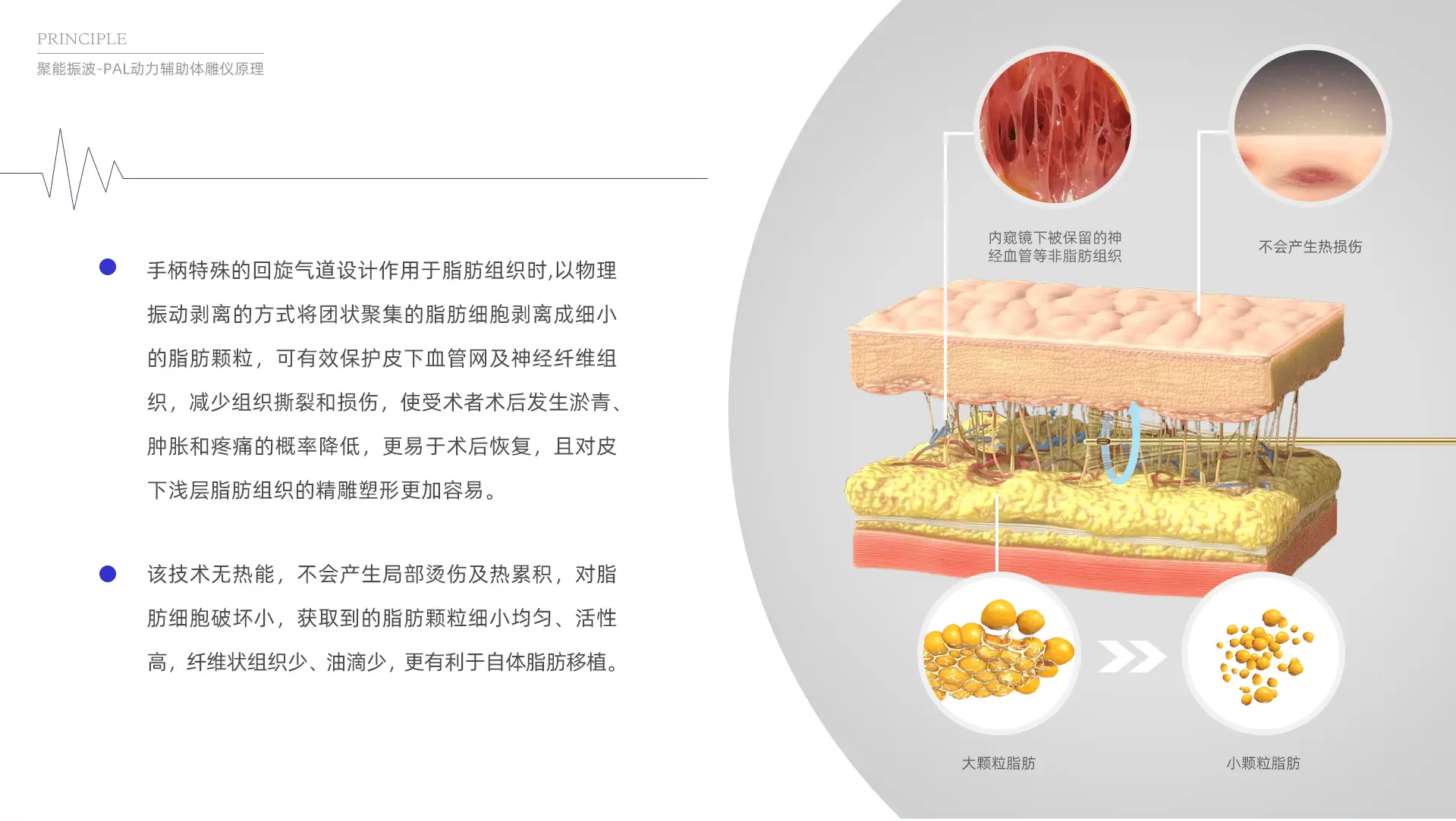 真實(shí)吸脂手術(shù)實(shí)例分享，術(shù)前術(shù)后對(duì)比一目了然