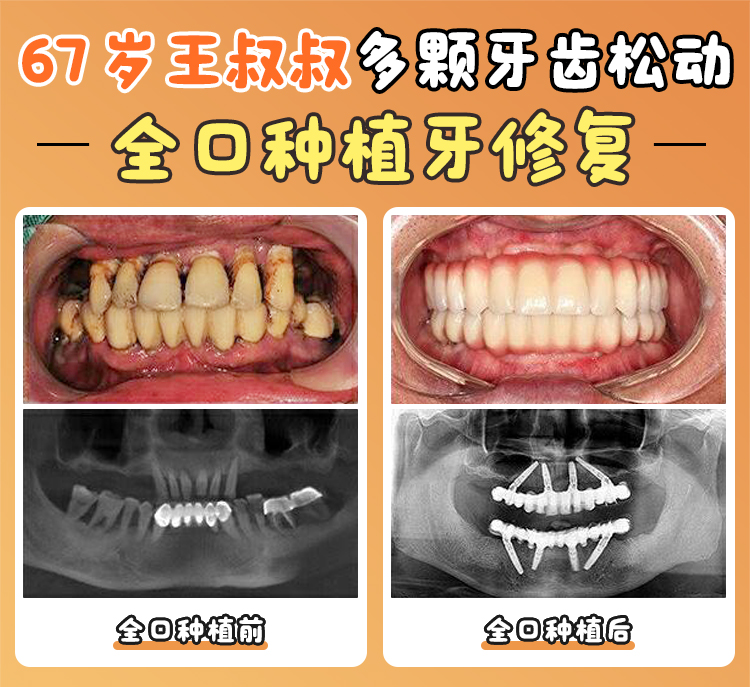 微信預(yù)約掛號：拼網(wǎng)速和手速
