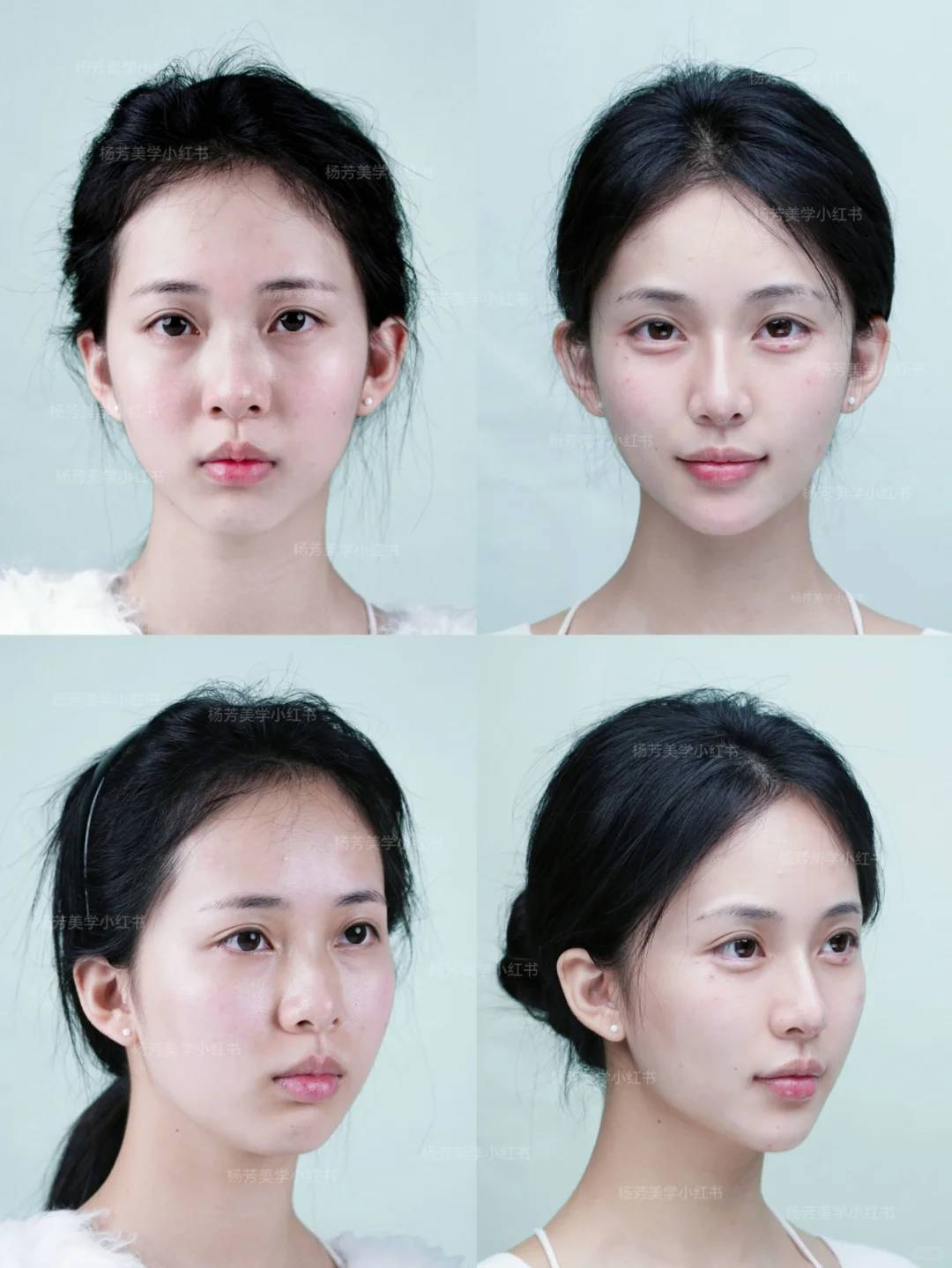 二、張軍利醫(yī)生擅長的輪廓提升項目有哪些？