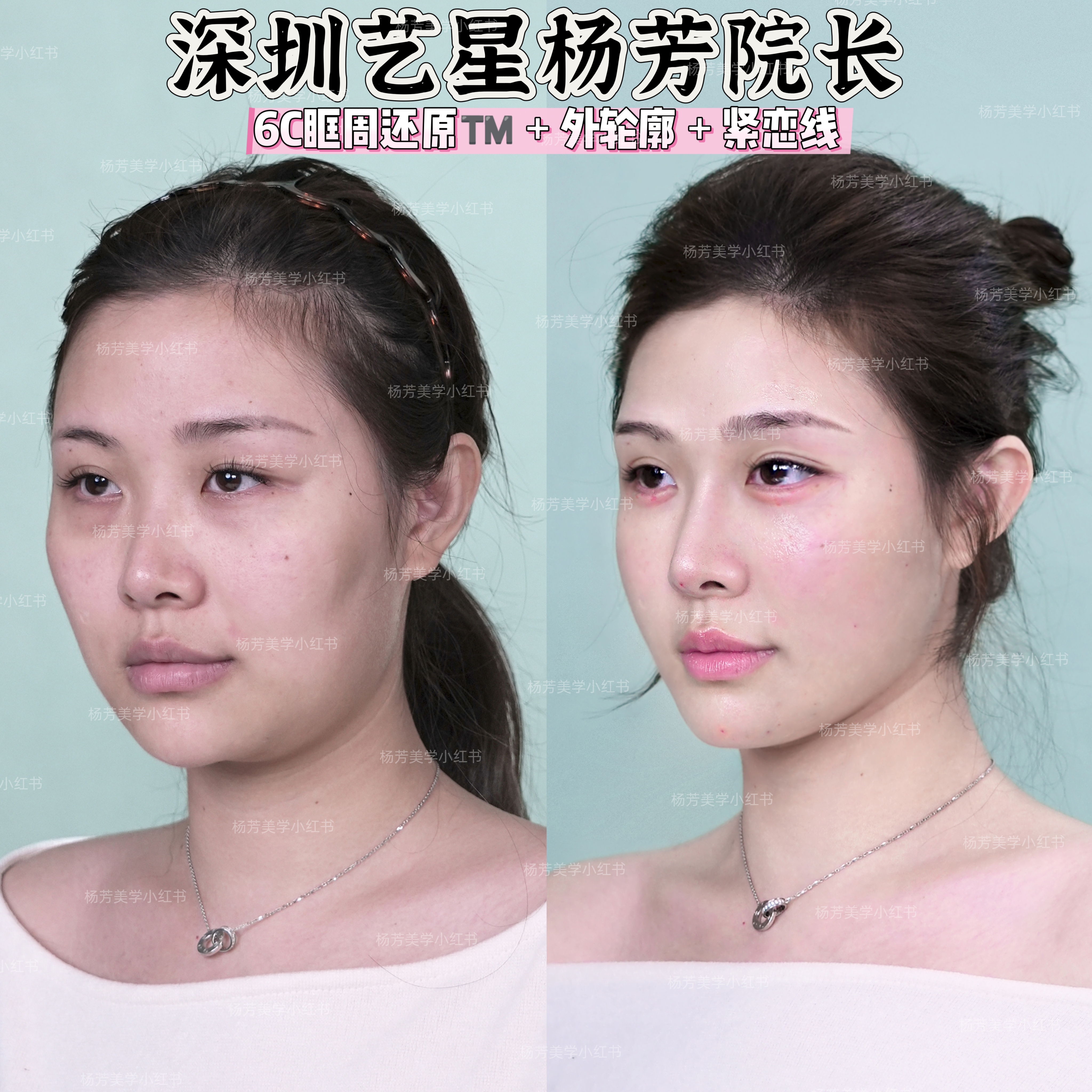 三、張軍利醫(yī)生的審美風(fēng)格：自然、精致、不刻意