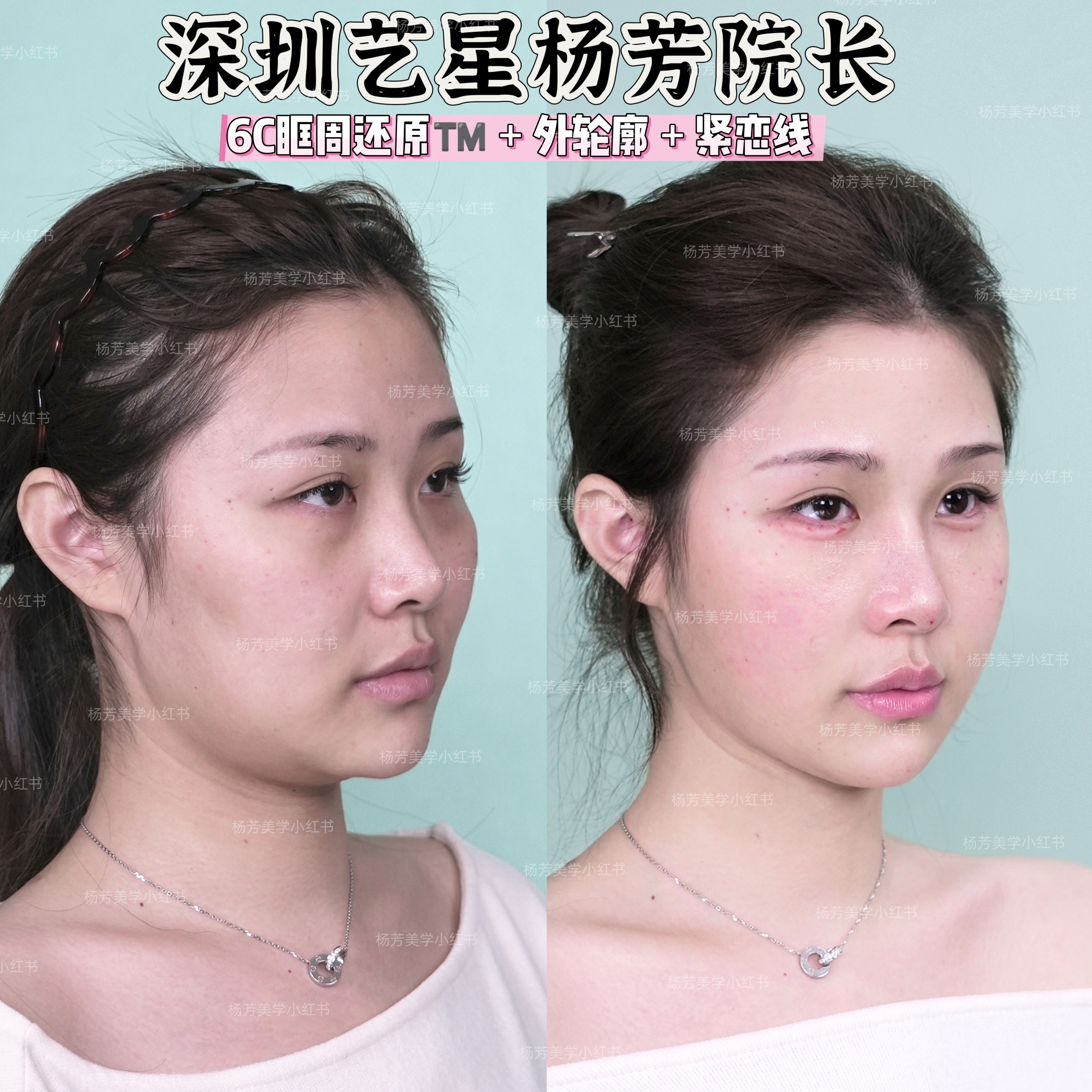 四、張軍利醫(yī)生的價格真的不貴嗎？