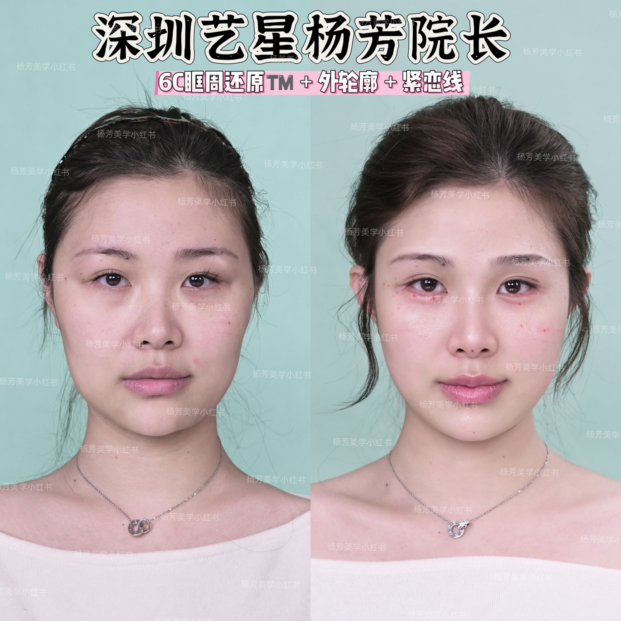 五、張軍利醫(yī)生的口碑怎么樣？