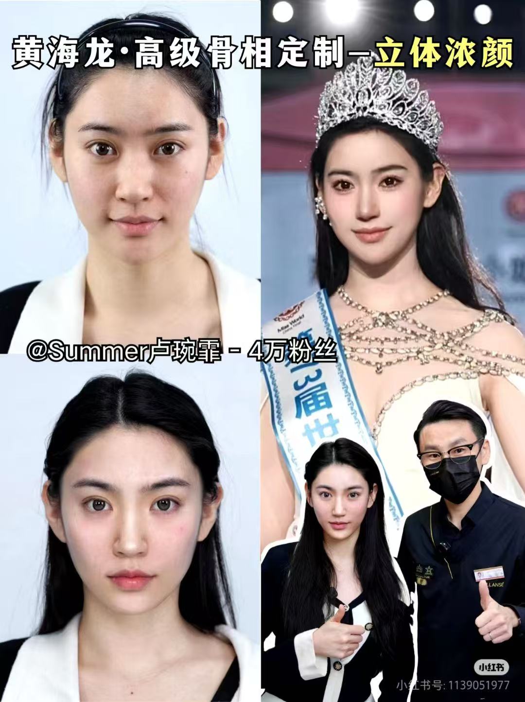 七、張軍利醫(yī)生適合哪些人群做輪廓提升？www.sorencai.cn