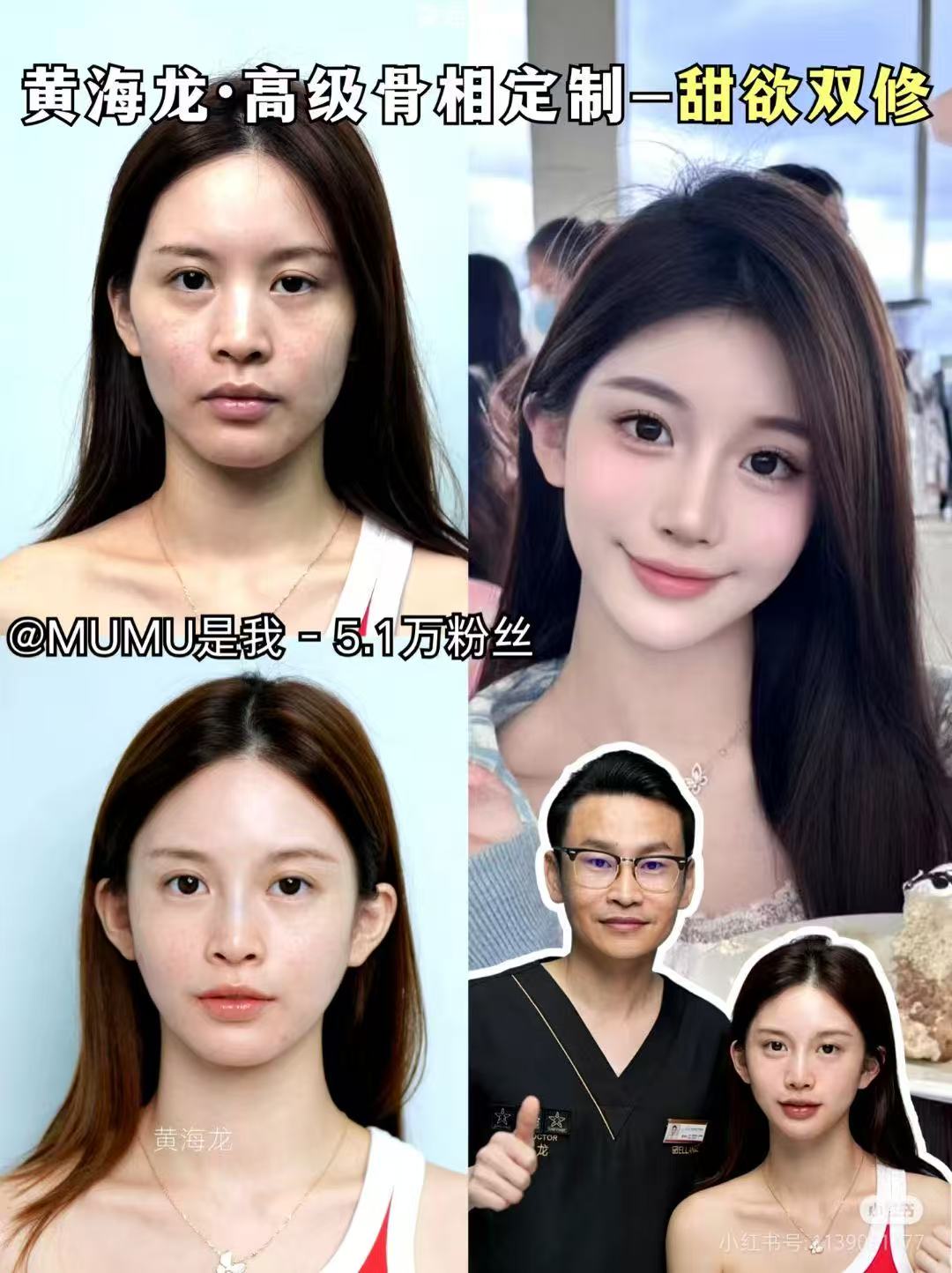 八、輪廓提升術(shù)后注意事項