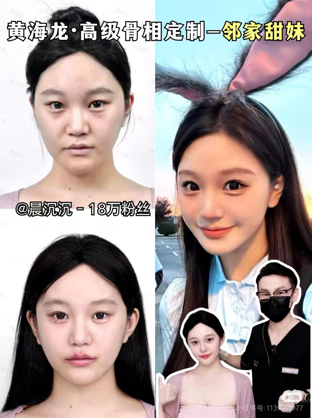 九、總結(jié)：張軍利醫(yī)生是值得信賴的輪廓提升醫(yī)生