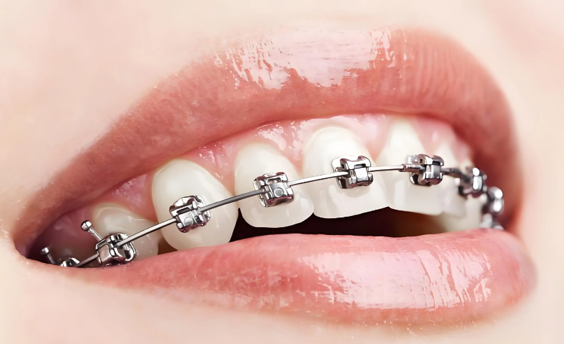 四、徐寶華正畸團(tuán)隊(duì)的專門特色與接診范圍