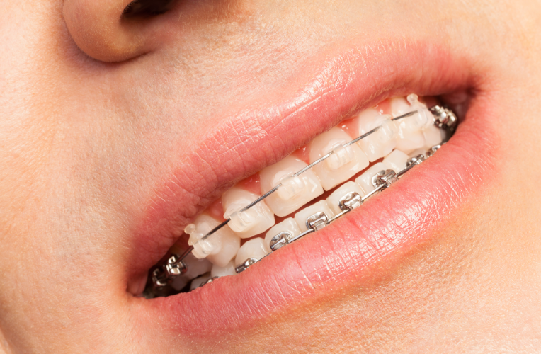 五、預(yù)約注意事項(xiàng)與常見(jiàn)問(wèn)題解答