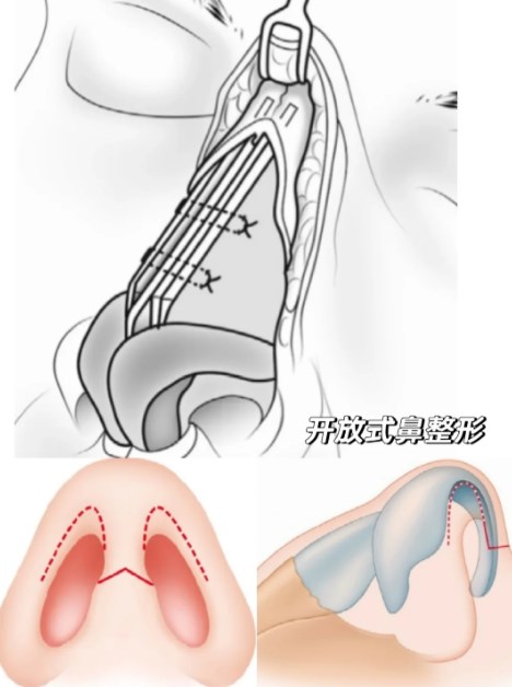 3. 典型案例參考（匿名整理）