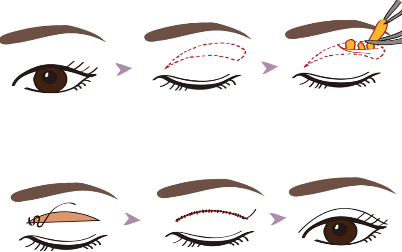 長沙鄒俊峰在哪家醫(yī)院？