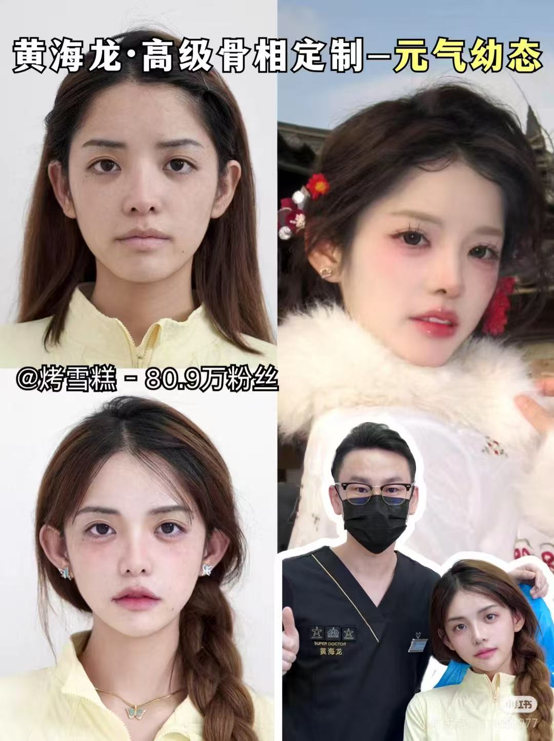 8. 申濤（上海美萊醫(yī)療美容醫(yī)院）