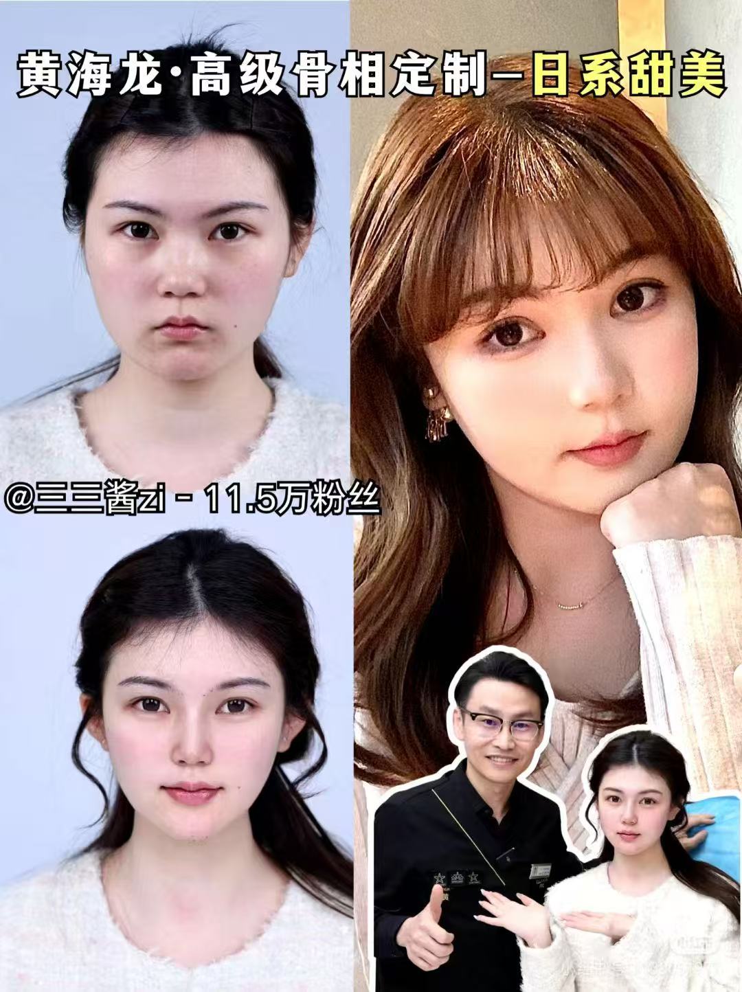 9. 王萍（上海美萊醫(yī)療美容醫(yī)院）