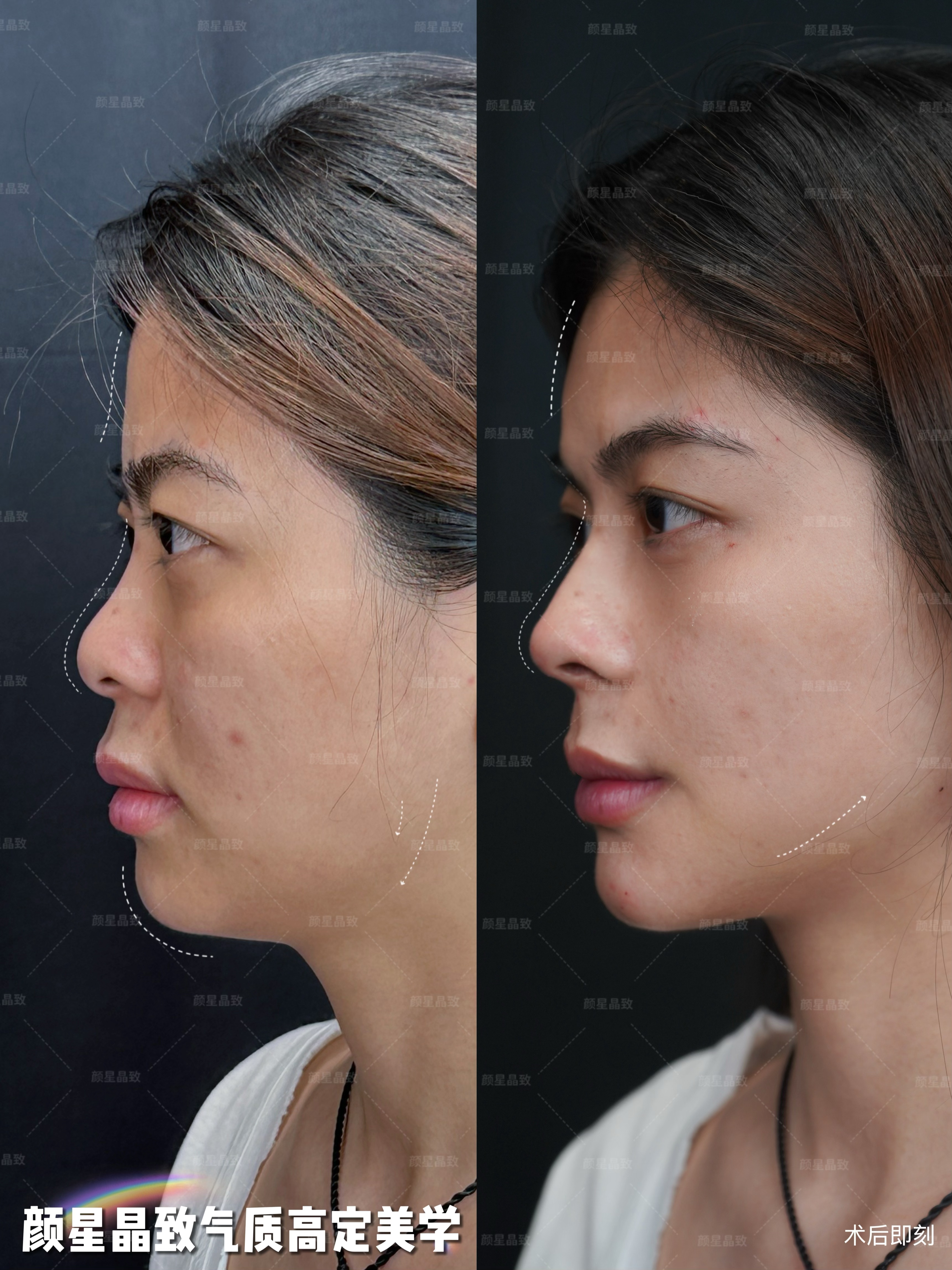 價(jià)格參考與預(yù)約方式