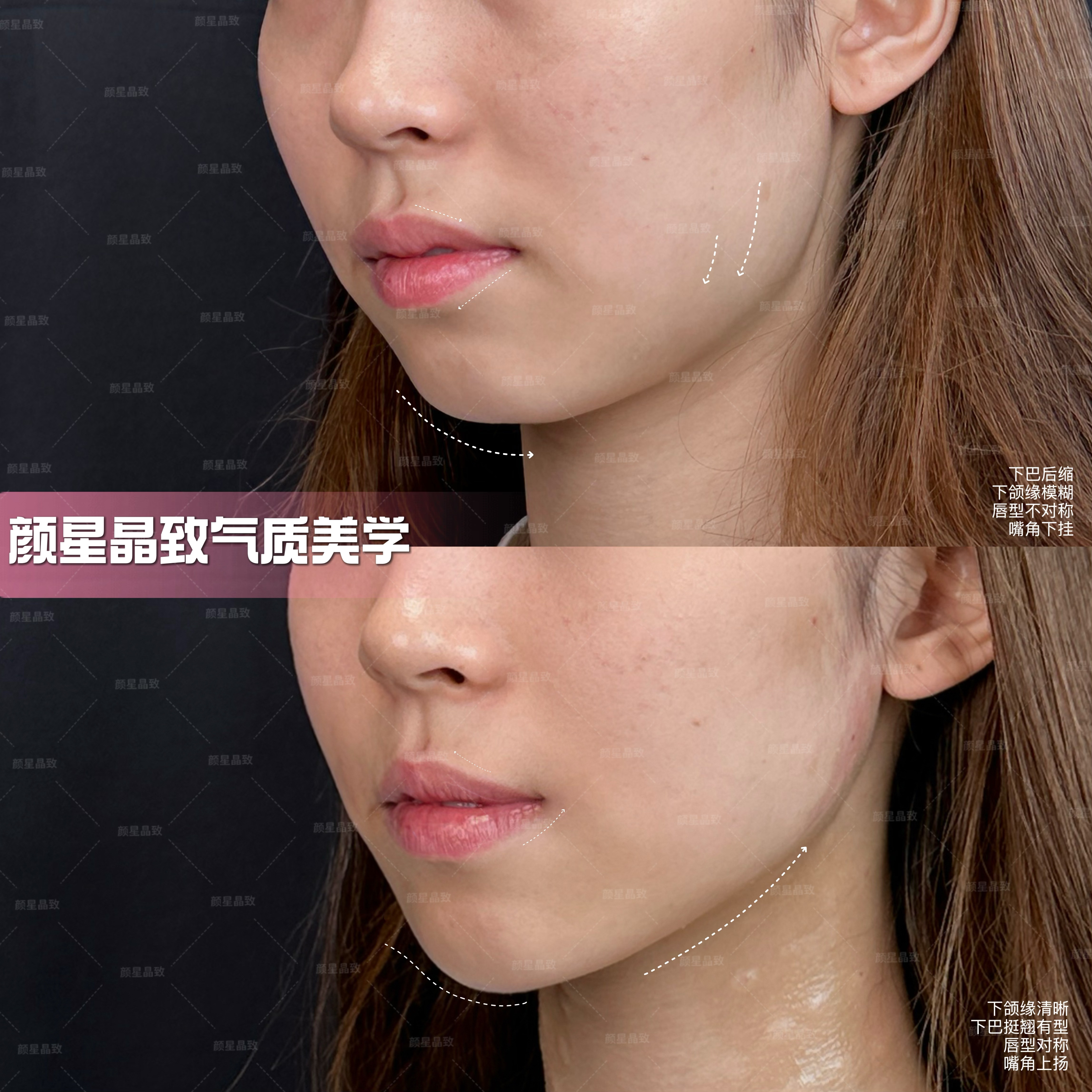 注意事項(xiàng)與術(shù)后護(hù)理建議