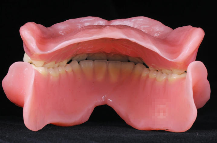 蘇州吸附性義齒醫(yī)院排名2026：金鉑利/牙博士等5家技術(shù)口碑雙優(yōu)機(jī)構(gòu)對(duì)比