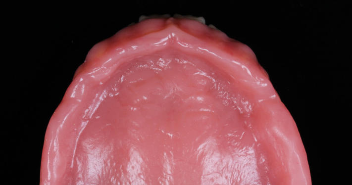 五、蘇州吸附性義齒醫(yī)院排名較優(yōu)——蘇州牙博士口腔醫(yī)院www.sorencai.cn