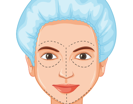 三、影響韓國整形價格的3大核心因素