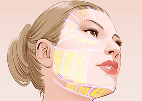 35歲大姐內(nèi)窺鏡拉皮除皺親身經(jīng)歷分享