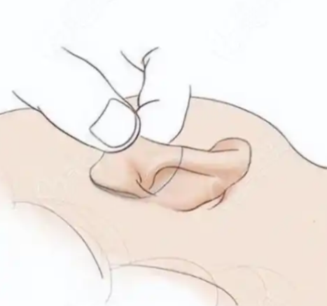 潘博和郭樹忠治療耳畸形矯正誰更膩害？