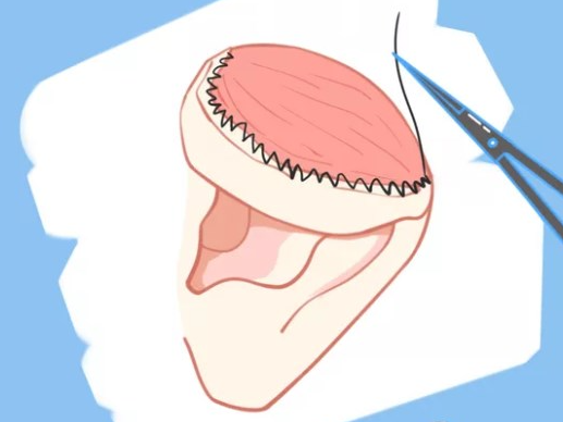 手術(shù)量與經(jīng)驗(yàn)對(duì)比