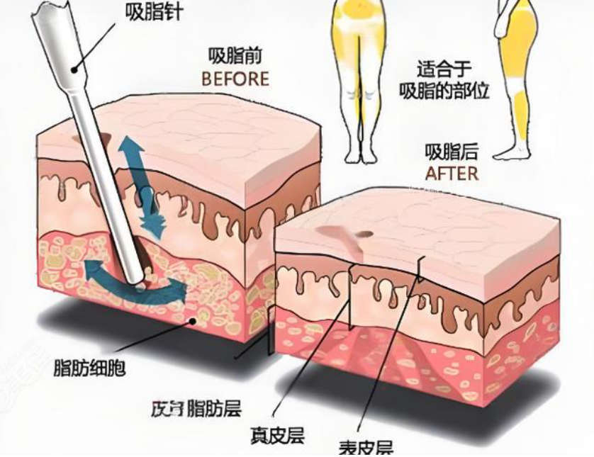 為什么石家莊沒有馮斌脂雕