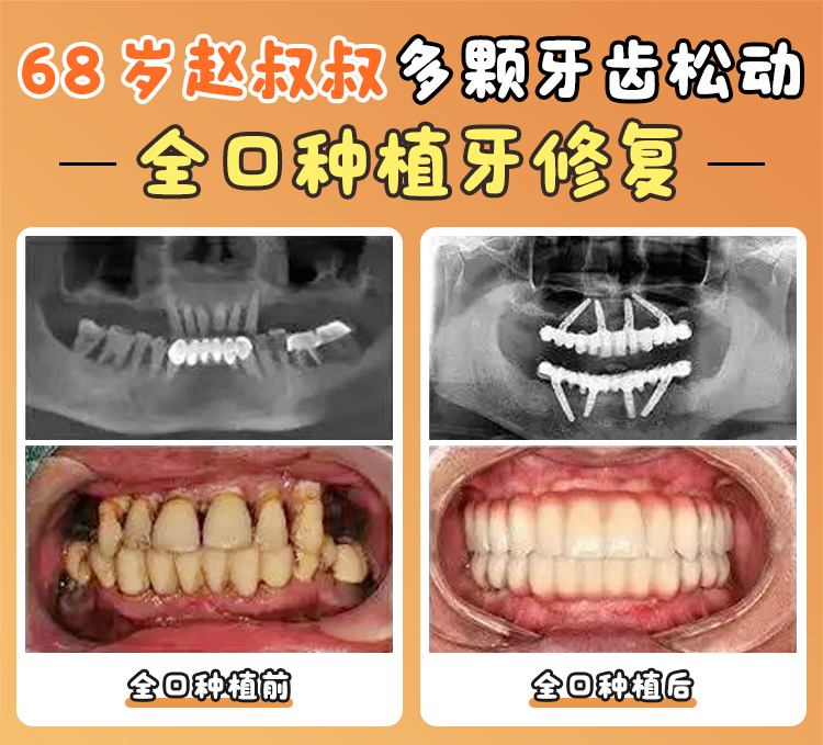 五、其他上榜口腔機(jī)構(gòu)簡(jiǎn)要介紹