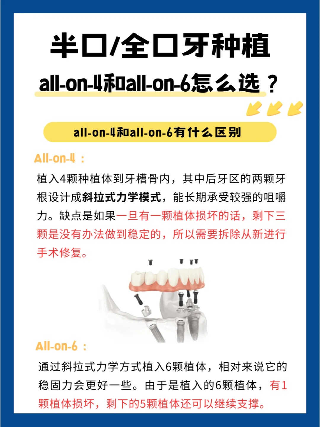 七、如何選擇適合自己的種植牙機(jī)構(gòu)？