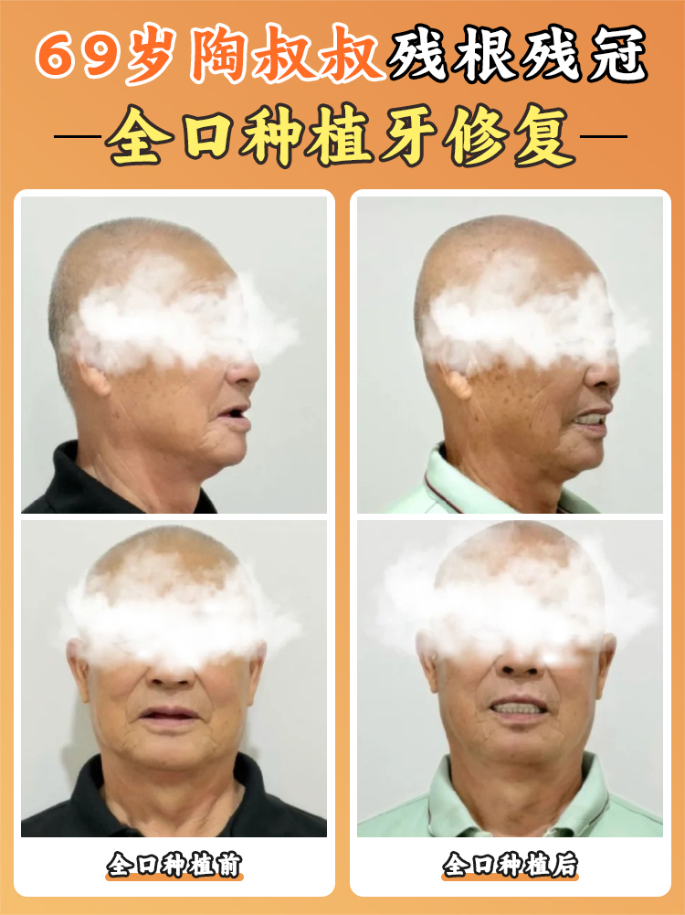 上海瑞伢美口腔怎么樣——特色項(xiàng)目技術(shù)優(yōu)www.sorencai.cn