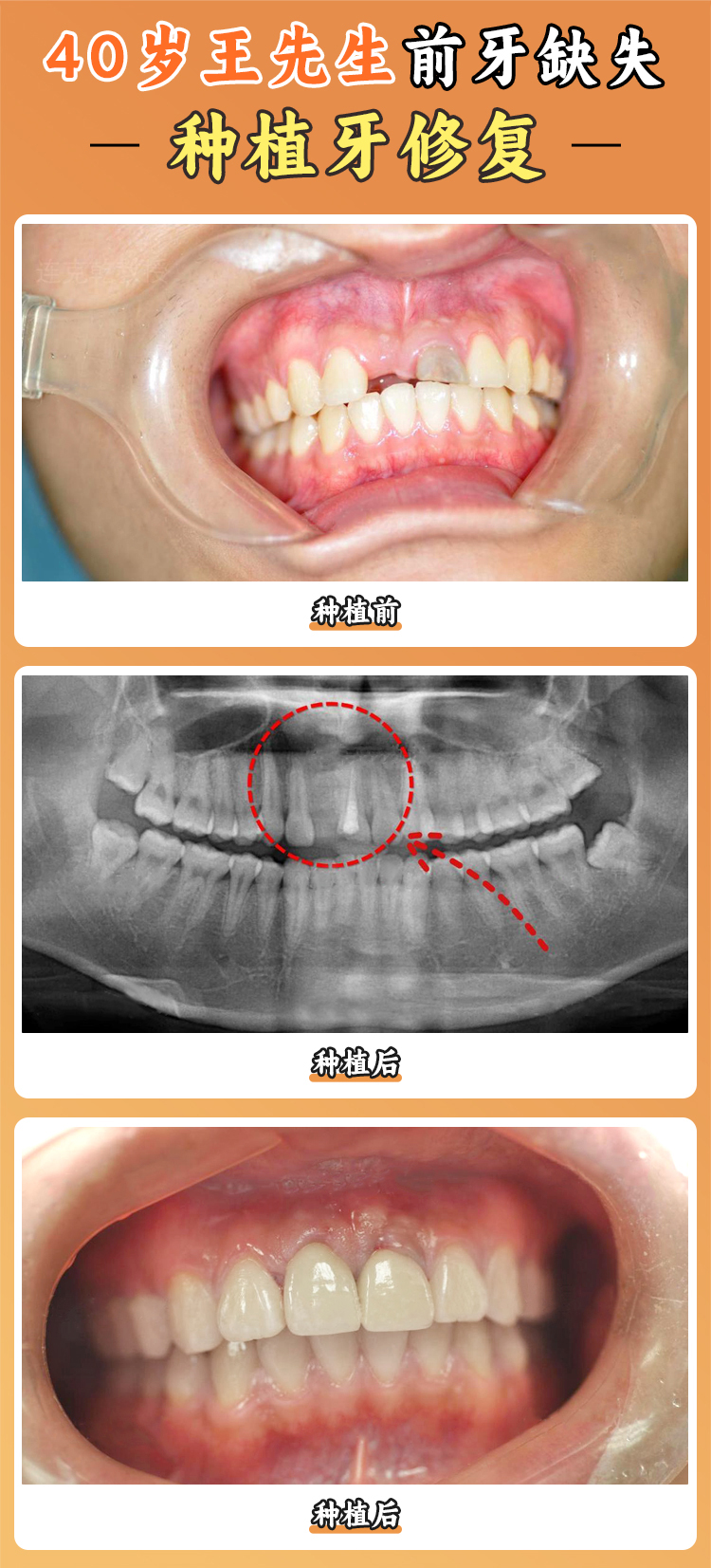 上海瑞伢美口腔怎么樣——醫(yī)生團(tuán)隊(duì)實(shí)力強(qiáng)