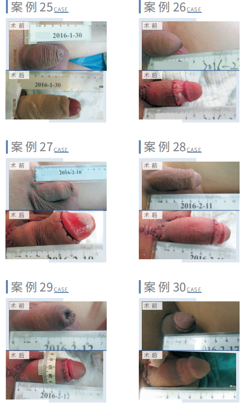 七、預(yù)約方式與醫(yī)院地址