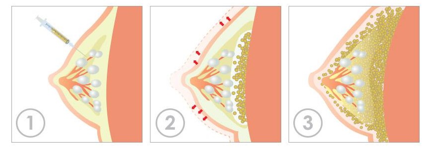 輕度皮膚松弛矯正項(xiàng)目