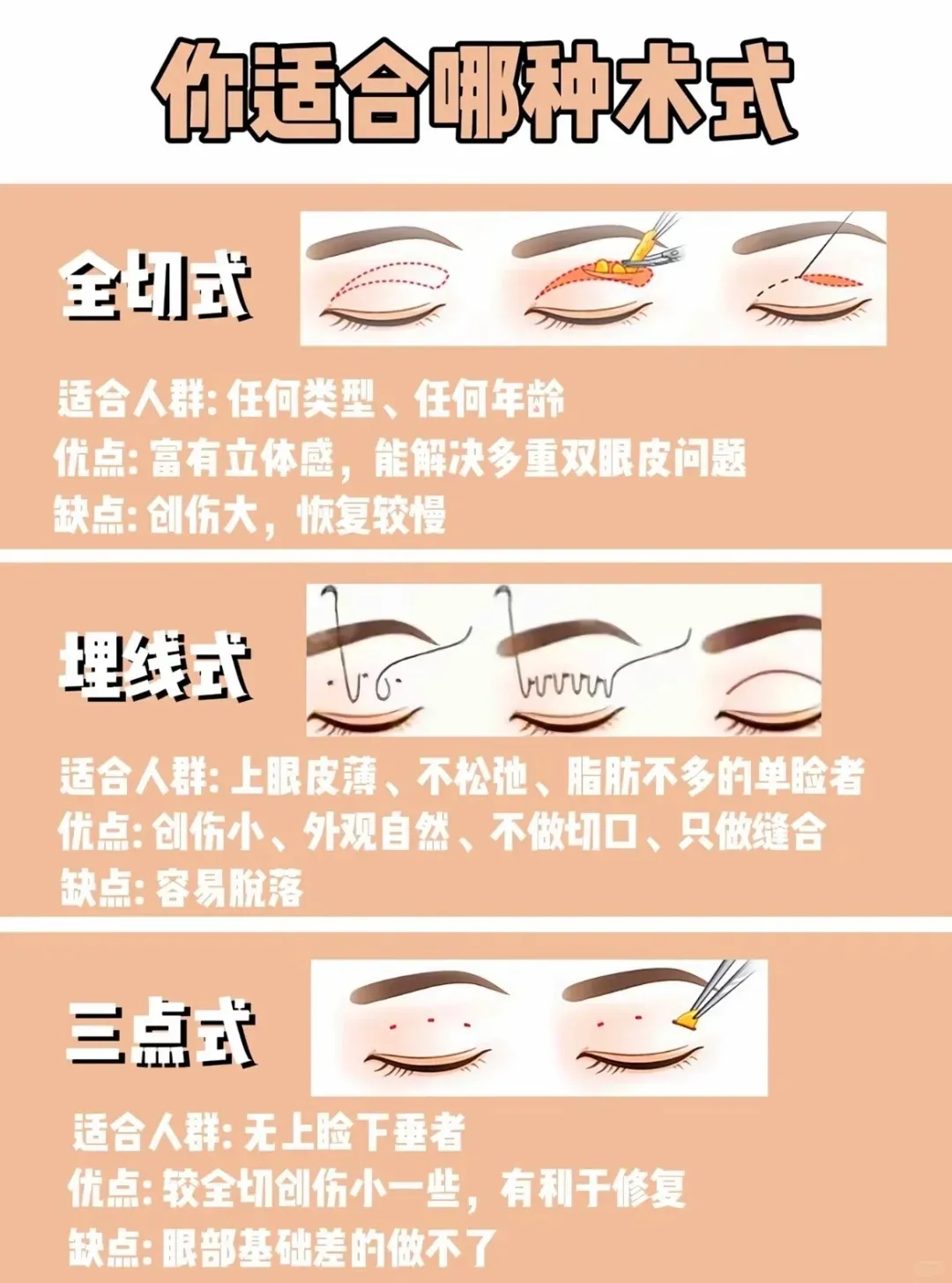 四、如何選擇靠譜的雙眼皮手術醫(yī)生？五大評估標準