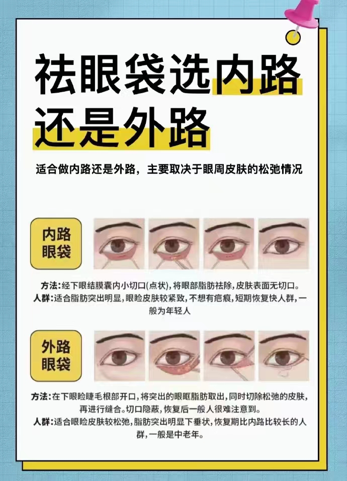 朱冠峰7D不開刀去眼袋技術(shù)：革新性突破