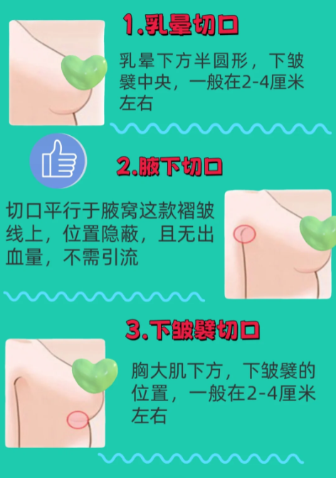 宋寶驥男性乳腺切除手術(shù)價(jià)格表2026：微創(chuàng)與傳統(tǒng)方式費(fèi)用對(duì)比分析