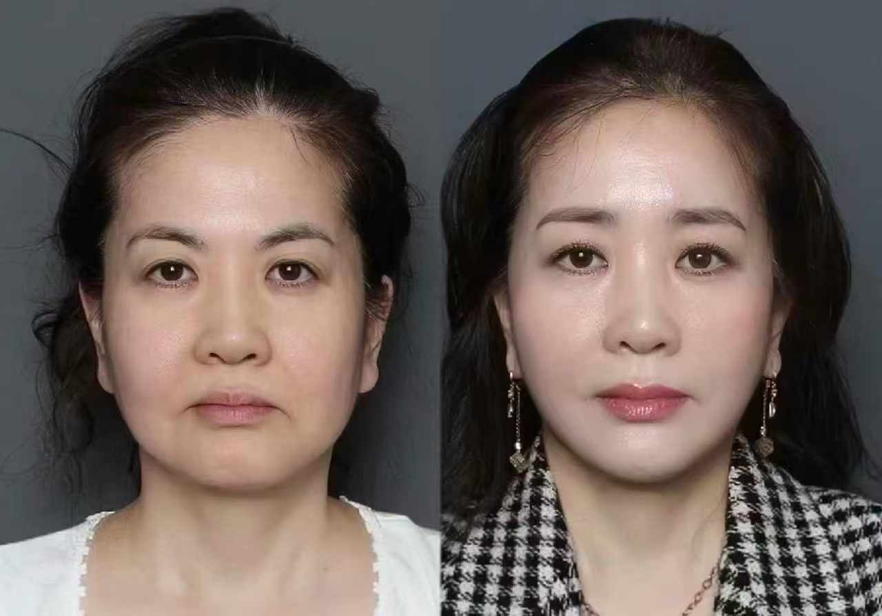 二、楊喆醫(yī)生坐診醫(yī)院及地址