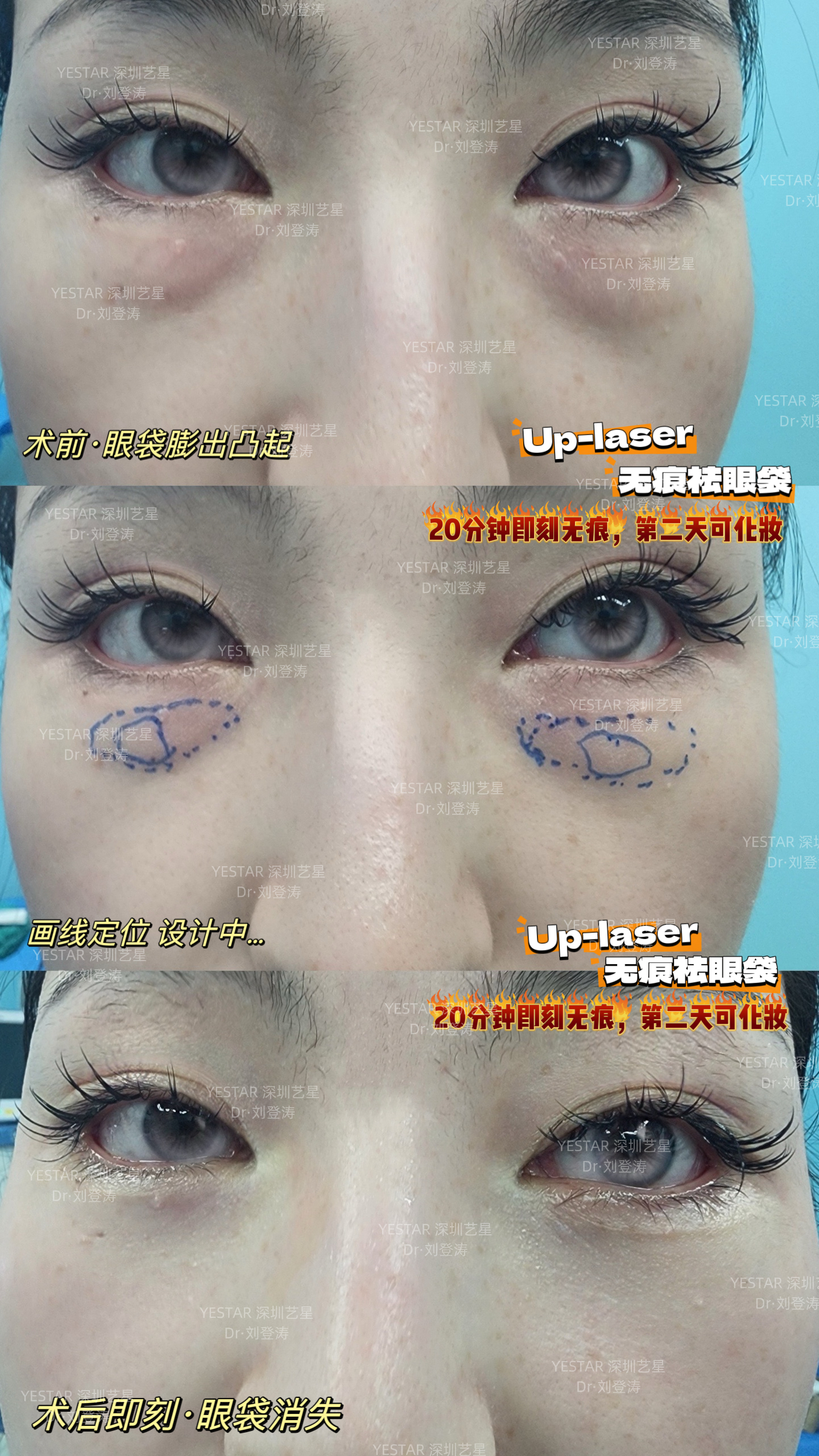 朱冠峰醫(yī)生預(yù)約：開啟美麗之旅