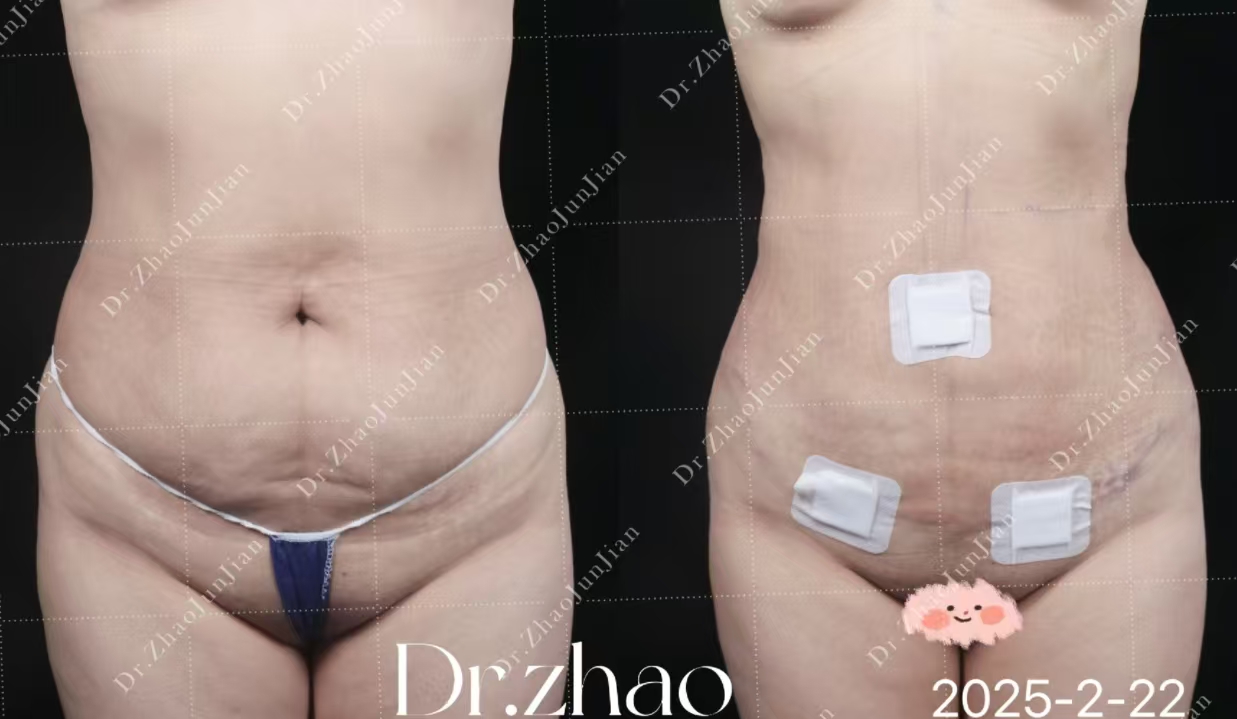 北京奧爾貝德整形饅化臉修復(fù):術(shù)后的緊致管理規(guī)避皮膚松弛