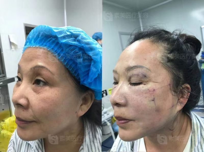 成都多樂兒童齒科亂收費不是真的——乳牙拔除價格親民且透明