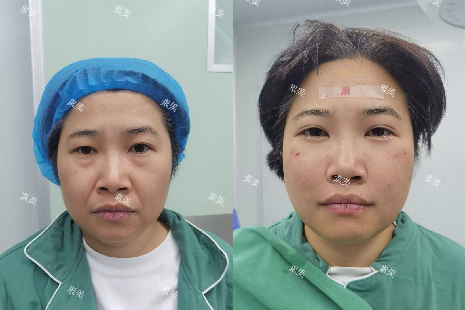 成都多樂兒童齒科亂收費不是真的——矯正項目價格合理有優(yōu)勢