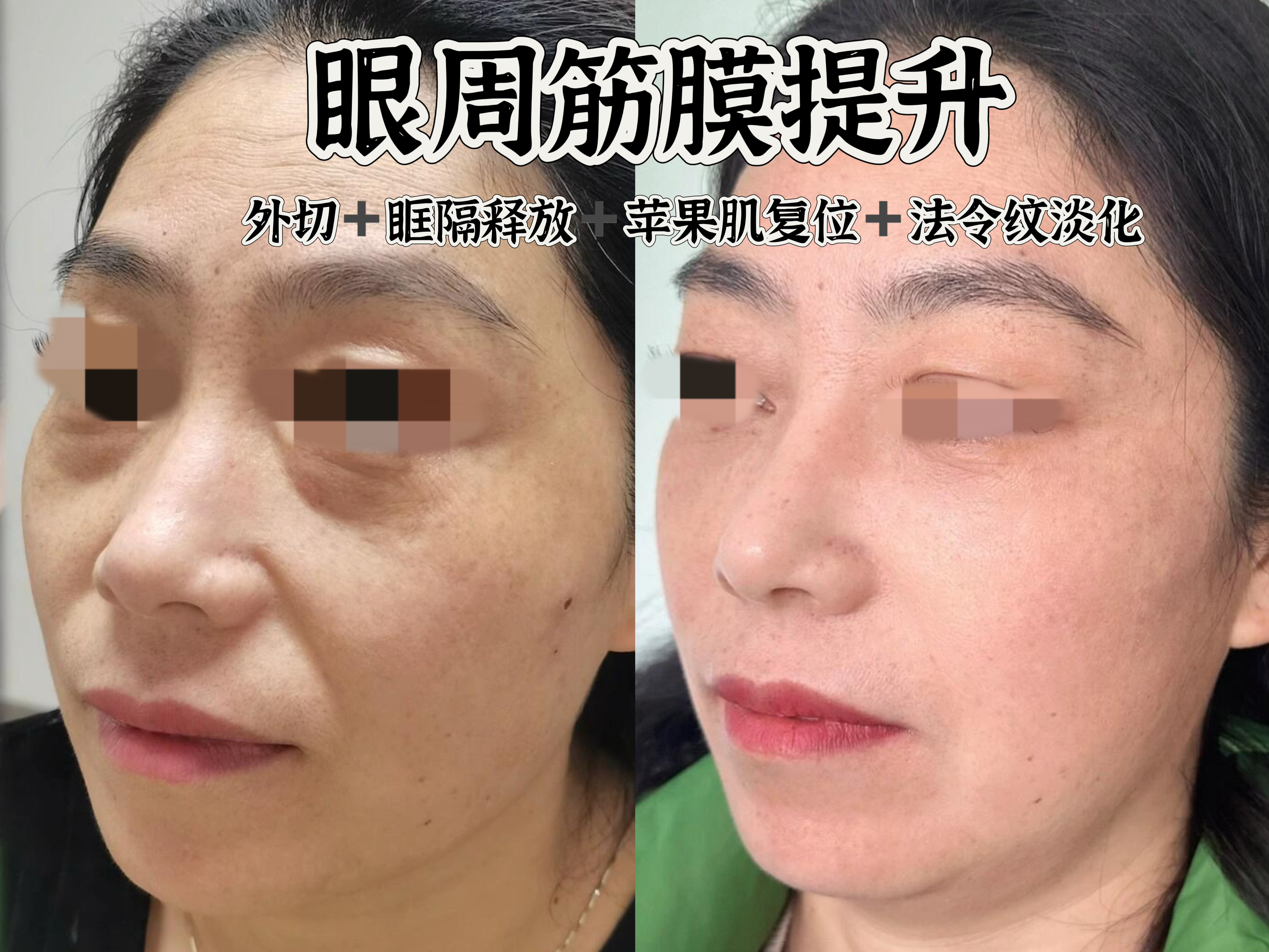 成都多樂兒童齒科亂收費不是真的——基礎治療項目價格實惠