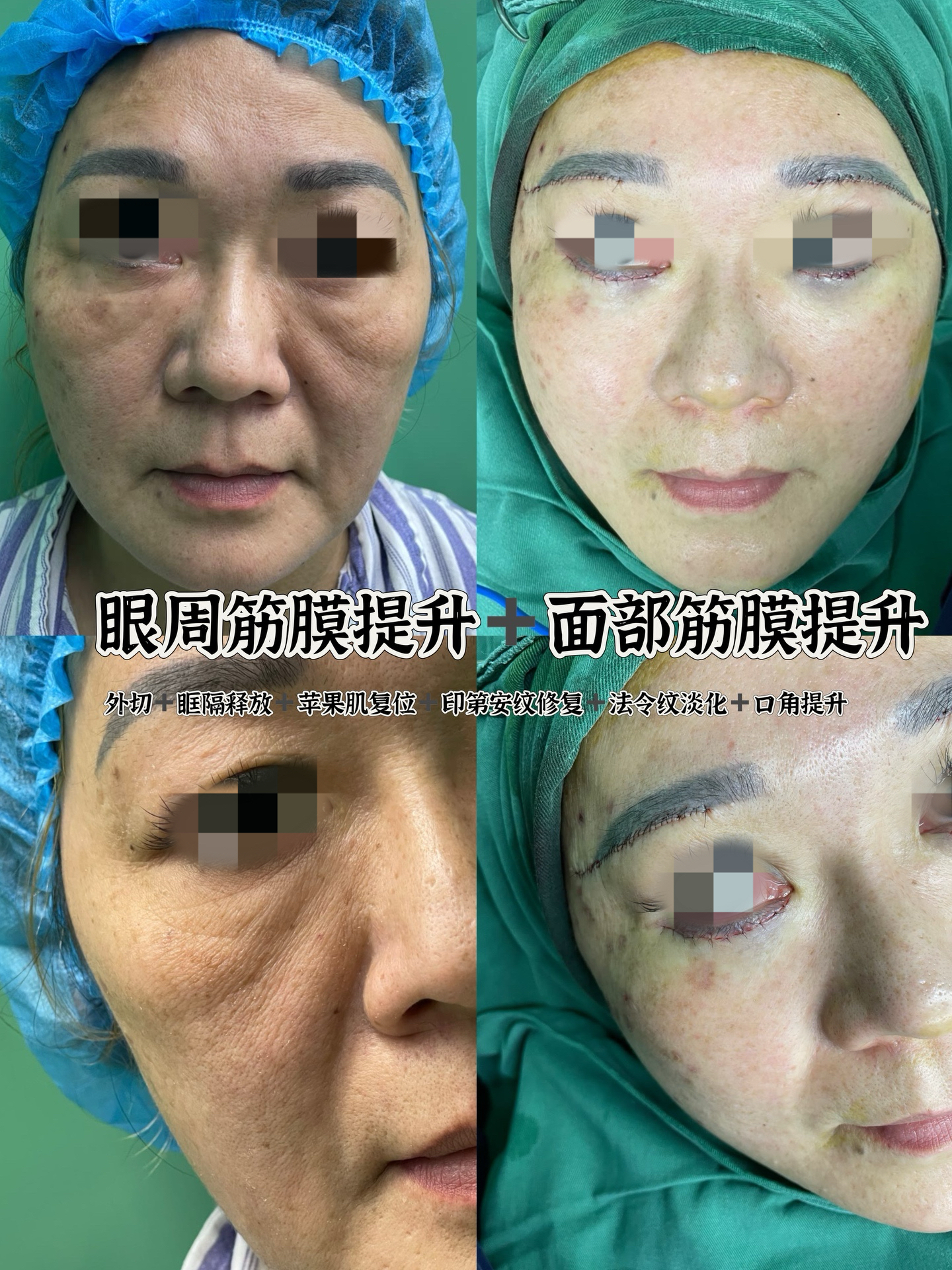 成都多樂兒童齒科亂收費不是真的——優(yōu)質(zhì)服務提升收費性價比www.sorencai.cn