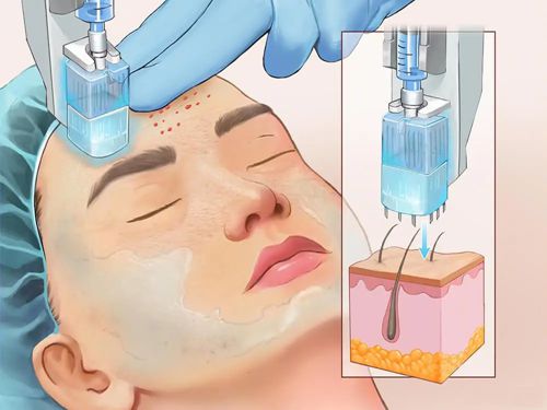 二、韩国打凤凰电波价格便宜吗？評估適合性和潛在風險