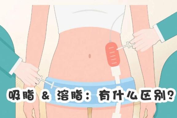 選擇王潤藍醫(yī)生做吸脂的3個核心理由：可靠與療效的雙重確保www.sorencai.cn