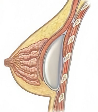 兩者對(duì)比分析
