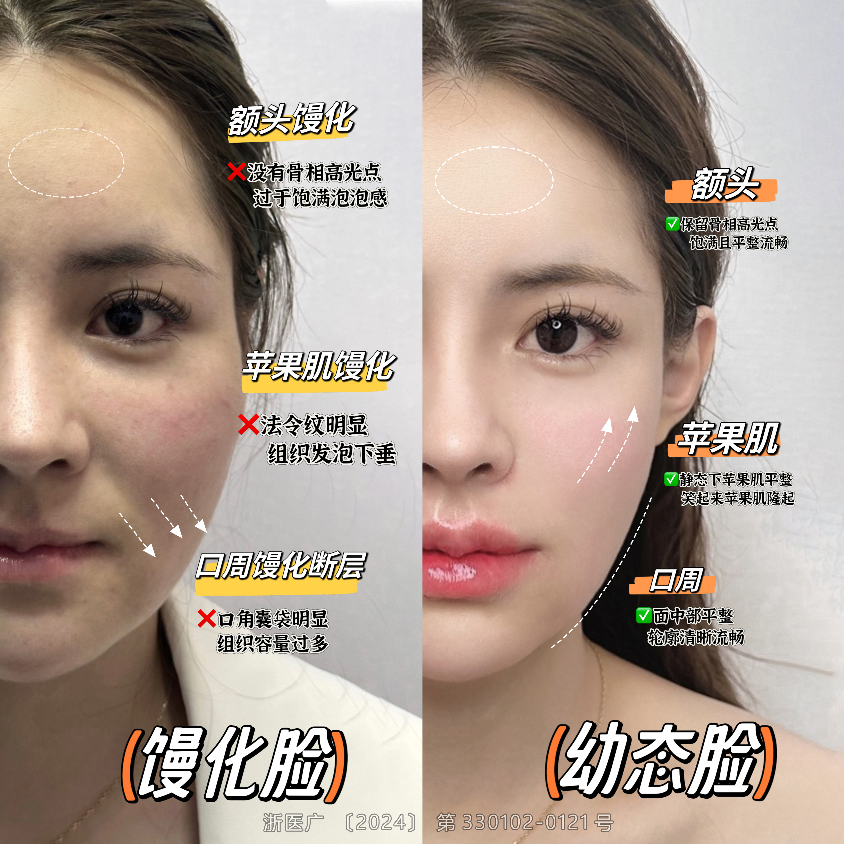 一、上海華美聶婕醫(yī)生簡(jiǎn)介：經(jīng)驗(yàn)多，背景強(qiáng)大