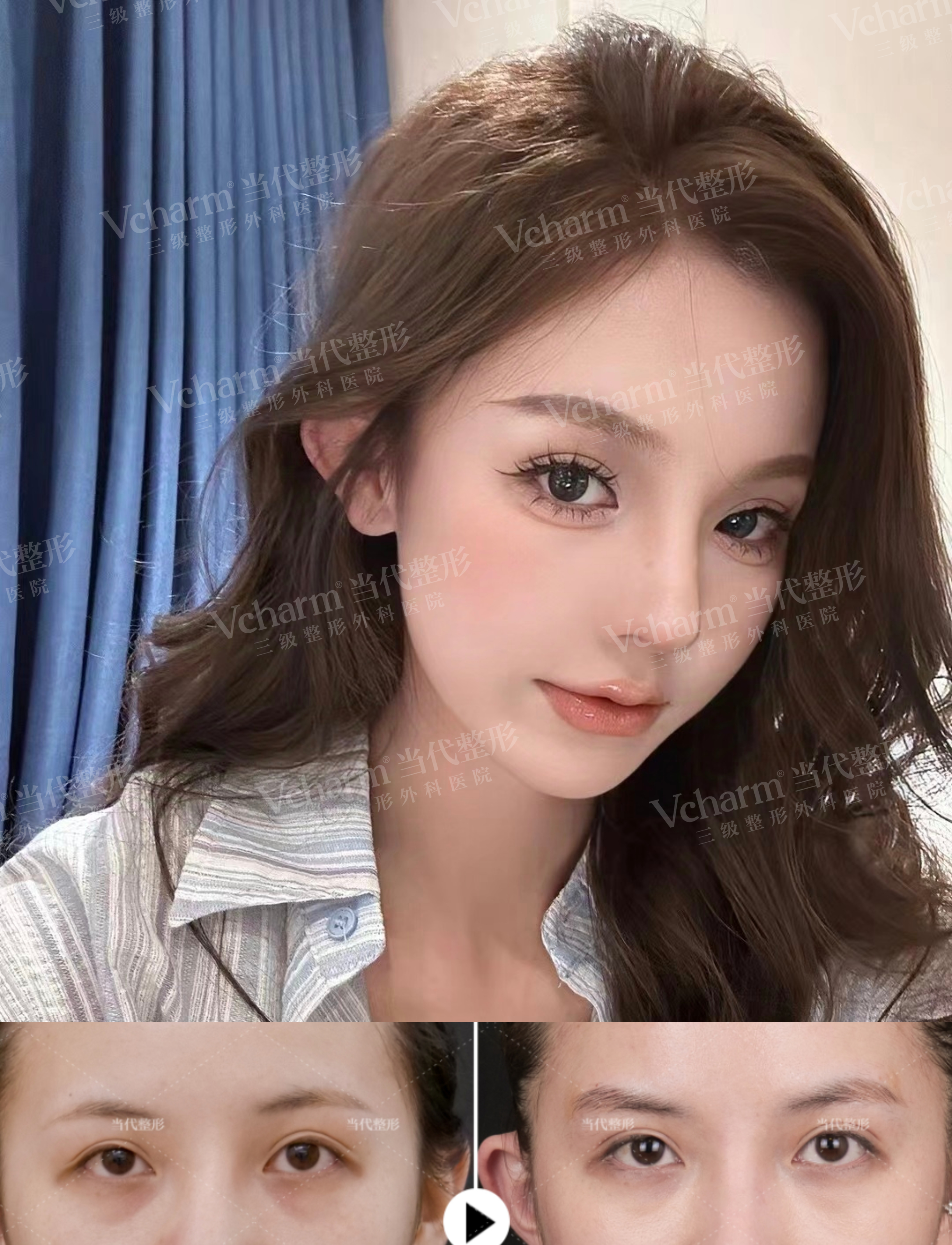 孟寶璽醫(yī)生怎么預(yù)約?三種掛號(hào)預(yù)約方式輕松約面診,雙眼皮/眼修復(fù)放心選